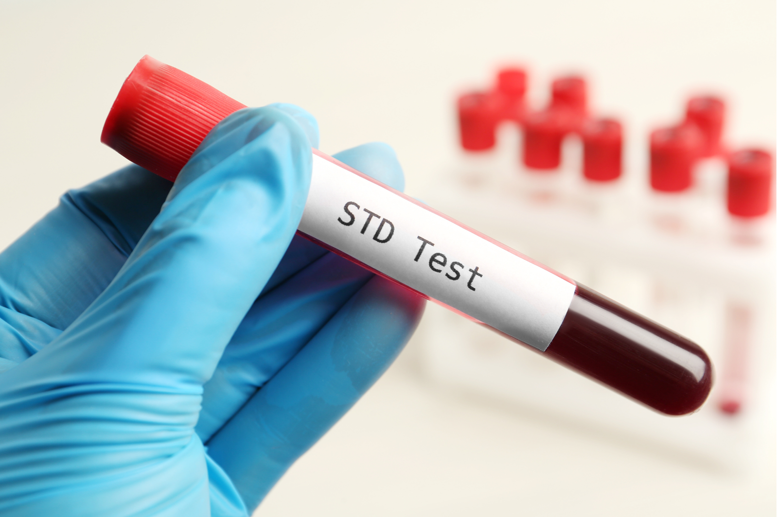 Comprehensive STD Test 13 Parameters