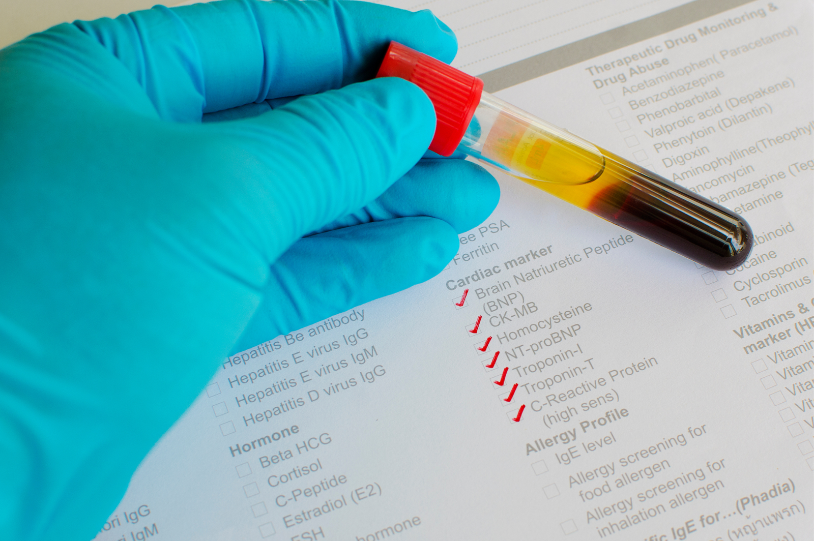 STD 09 PATHOGEN TEST